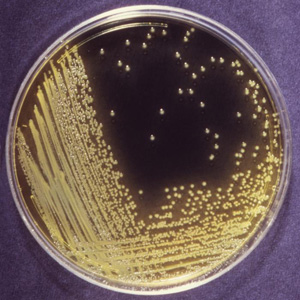 Photo of agar plate which has half bacteria growing and half clear agar.